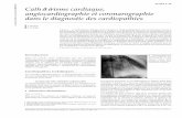 Cathétérisme cardiaque, angiocardiographie et coronarographi