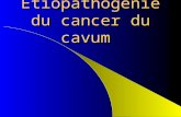 Cancer du cavum étiopathogénie