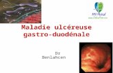 Maladie ulcéreuse gastro-duodénale.ppt