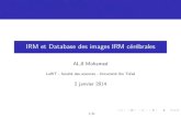 IRM et Database des images IRM cérébrales