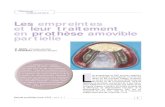Les empreintes  et leur traitement  en prothèse amovible  partielle  Clinique  Laboratoire