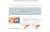 Laryngectomie totale.pdf