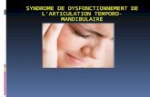 Syndrome algo-dysfonctionnel de l'appareil manducateur ou SADAM