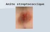 Anite streptococcique