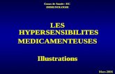 Cours 4e Année - EC  IMMUNOLOGIE LES HYPERSENSIBILITES MEDICAMENTEUSES Illustrations
