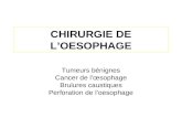 CHIRURGIE DE L’OESOPHAGE