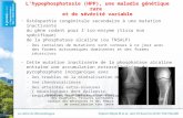 L’ hypophosphatasie  (HPP), une maladie génétique rare  et de sévérité variable