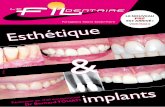 Le fil dentaire n°83: Esthétique et implants