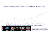 Plaques Amyloides Dans Les Démences Non Alzheimer Dr-KAS Neurologie Janvier 2012