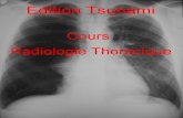 Cours Radiologie Thoracique