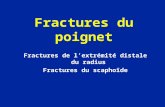 Poignet - Fractures