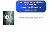 2013 039. Prothèse fémoro-patellaire : coupe trochléenne ou resurfacage 39