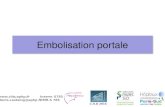 Embolisation portale  - Dr Fernando Alvarez - Pr Denis Castaing