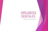 Implantes dentales angie paola