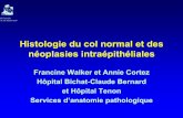 Histologie du col normal et des néoplasies intraépithéliales