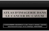 ATLAS D’IMAGERIE DANS LE CANCER DU CAVUMpe.sfrnet.org/Data/ModuleConsultationPoster/pdf/2010/1/1e6eaebe-f... · ATLAS D’IMAGERIE DANS LE CANCER DU CAVUM Z.JAMALEDDINE; S.ELHADDAD,