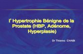 l Hypertrophie Bénigne de la Prostate (HBP, Adénome ... · PDF fileGénéralités - Définition: Tumeur bénigne caractérisée par une hyperplasie adénofibroleiomyomateuse de la