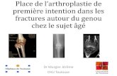 PTG dans les traitement des fractures autour du genouhipnews.org/sanofi/2017/Biarritz présentation J MURGIER.pdfWeiss NG: J Bone J Surg Am. 2003. Shimizu T.: Journal of Orthopaedic