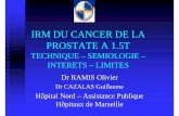 IRM DU CANCER DE LA PROSTATE A 1 - pe.sfrnet.orgpe.sfrnet.org/Data/ModuleConsultationPoster/pdf/2008/1/21bbb4fb-70... · IRM DU CANCER DE LA PROSTATE A 1.5T TECHNIQUE – SEMIOLOGIE
