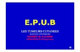 E.P.U - Epu B AMIENS(FRANCE) · • Suit les lignes de Blasko • Petits « comédons » en surface • Impression de lésion posée sur la peau? Quel est votre diagnostic? ... •