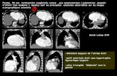 Femme, 58 ans. Cardiopathie congénitale connue , peu …onclepaul.net/wp-content/uploads/2011/07/maebFILEminimizer1.pdf · Femme, 58 ans. Cardiopathie congénitale connue , peu symptomatique