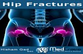 Author - Medcravemedcraveonline.com/ebooks/mojor-hip-fractures.pdf · Special Types of Hip Fractures 15 Stress fracture of the femoral neck (SFFN)