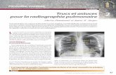 La radiologie Trucs et astuces 2 pour la radiographie … Medecin du Quebec... · Quels sont ces repères anatomiques ? Un dessin vaut mille mots. Sur le cliché de face (photo 1),