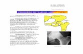 PDF Compressor - orthopale.org · L 'implantation de la protnèse avec une assistance chirurgicale par ordinateur pourrait ameliorer la technique de pose de la prothèse et réduire