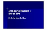 Imagerie Rapide EG EPI DES - sfrnet.org Rapide EG EPI DES.pdf · Etat d’équilibre + gradients équilibrés Limitation des artéfacts de flux, très rapide Indications : Imagerie