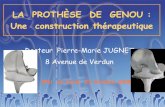 LA PROTHÈSE DE GENOU : Une construction …chirurgie-orthopedique-nice.com/epu_ptg.pdf · LA GONARTHROSE. Début d’arthrose fémoro-tibiale interne sur génu varum LA GONARTHROSE.