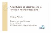 Anesthésie et atteintes de la jonction neuromusculaire · Myasthénie Graves et Anesthésie Interactions médicamenteuses Agents volatiles Potentialisation de l’effet de relaxation