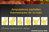 amputations Partielles Traumatiques De La Main - Irrirr-nancy.fr/IMG/File/AMPUTATIONS PARTIELLES 2010 PDF.pdf · DUHAM janvier 2010. Prise en charge en ergothérapie Principes : Accélérer