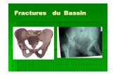 Fractures du Fractures du BassinBassin · gravité des fractures du bassin Prescrire et hiérarchiser les examens complémentaires aussi bien biologiques que ... La fracture du bassin