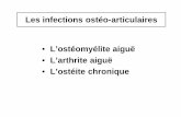 Les infections ostéo-articulaires L’ostéomyélite aiguë L ...naifox.free.fr/K2/Rhumatologie/Infections osteo-articulaires 2.pdf · Ostéomyélite aiguë hématogène de l ’enfant.