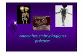 Anomalies embryologiques précoces - chu … · cloacale (troisième semaine de développement) 16 Anomalie du pôle postérieur embryonnaire Progression de la notochorde. 17 Rotation