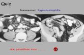 homosexuel, hyperéosinophilie - onclepaul.netonclepaul.net/wp-content/uploads/2011/07/QUIZZ-GILLES-G-07-A.pdf · • un signe clinique méconnu : l’aggravation ... iléale (tumorale