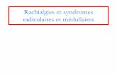 Rachialgies et syndromes radiculaires et médullaires 3D ULB/16-02-29 Rachialgies... · Myélite aiguë Tumeur Epidurite Lésion discale Hématome intrarachidien - Stade choc spinal