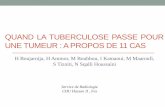QUAND LA TUBERCULOSE PASSE POUR UNE …pe.sfrnet.org/Data/ModuleConsultationPoster/pdf/2013/1/85011c0f-ea... · service de radiologie du CHU FES sur une période de 2 ans. Tous nos