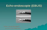 Echo-endoscopie (EBUS) - cphg.org€¦ · Quelles méthodes pour le staging ganglionnaire ? Méthodes non invasives –TDM –Tep scann Méthode invasives -gold standard = chir (médiastino)