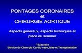 PONTAGES CORONAIRES et CHIRURGIE AORTIQUEonclepaul.net/wp-content/uploads/2011/07/pontages-coronaires... · Chirurgie décrite et réalisée pour la première fois en 1968 -Quel principe?
