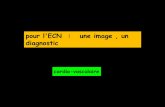 pour l'ECN : une image , un diagnostic - onclepaul.netonclepaul.net/wp-content/uploads/2011/07/une-image-un-diagnosic... · le décalage postérieur et le chevauchement des fragments