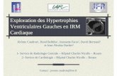 Exploration des Hypertrophies Ventriculaires Gauches …pe.sfrnet.org/Data/ModuleConsultationPoster/pdf/2008/1/5229d8c2-d3... · Chez les hommes > 238g en valeur absolue, > 113g/m²