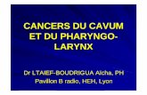 CANCERS DU CAVUM ET DU PHARYNGO-LARYNX … CAS CLINIQUE 3 M. Avd ., 60ans Obstruction nasale, ... molles du cou, à la thyroïde et /ou à l’oesophage. T1 : limitée aux cordes vocales
