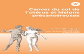 Cancer du col de l’utérus et lésions précancéreusesassets.krebsliga.ch/downloads/2070.pdf · la Ligue contre le cancer a aussi publié une brochure sur le cancer du corps de