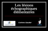 Les lésions échographiques élémentairesnaxos.biomedicale.univ-paris5.fr/diue/wp-content/uploads/2013/05/... · Toute plaque présente un risque d’embolisation ... Faux anévrysme