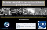 Lésions vasculaires microtraumatiques périphériquespe.sfrnet.org/Data/ModuleConsultationPoster/pdf/2013/1/b8cf124f-e... · Anévrysme 3. Interruption du flux partiellement ...