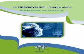 La FIBROMYALGIE : l’image réelle · sur la nécessité d'informer les personnes atteintes de fibromyalgie et de rendre les différents aspects liés à la maladie plus facile à