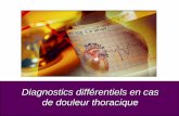 Diagnostics différentiels en cas de douleur thoracique · Maladie thromboembolique veineuse Ischémie myocardique Artériopathie périphérique Insuffisance cardiaque Fibrillation