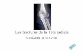 Les fractures de la Tête radiale - epaule-main.fr · Biomécanique du coude • Tête radiale stabilisateur multidirectionnel Stabilisateur frontal et sagittal Dr Judet Dr Judet.