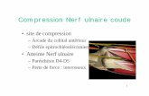 Compression Nerf ulnaire coude - sometrav-paca.org · 1 Compression Nerf ulnaire coude • site de compression – Arcade du cubital antérieur – Défile epitrochléoolécranien